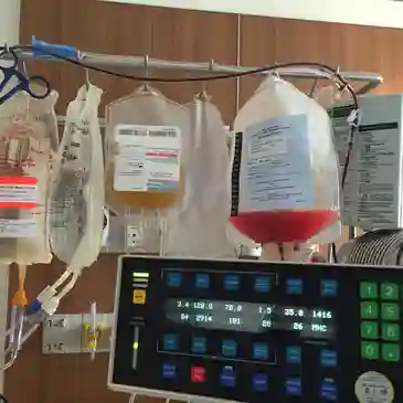 Over One Hundred Chemotherapy Infusions